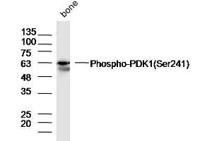 Mouse bone lysates probed with Rabbit Anti-PDK1(ser241) Polyclonal Antibody, Unconjugated  at 1:300 overnight at 4˚C.
