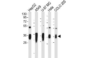 All lanes : Anti-AKR1C2 Antibody (C-term) at 1:2000 dilution Lane 1: HepG2 whole cell lysate Lane 2: A549 whole cell lysate Lane 3: U-87 MG whole cell lysate Lane 4: Hela whole cell lysate Lane 5: COLO 205 whole cell lysate Lysates/proteins at 20 μg per lane.