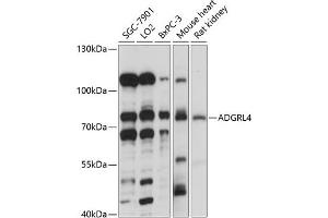 Western blot analysis of extracts of various cell lines, using  antibody (ABIN7266908) at 1:1000 dilution.