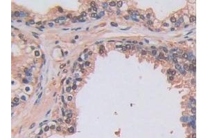 Detection of LOXL2 in Human Prostate Tissue using Polyclonal Antibody to Lysyl Oxidase Like Protein 2 (LOXL2)
