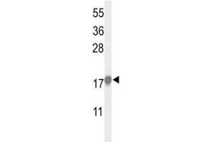 Western blot analysis of p21 antibody and HeLa lysate