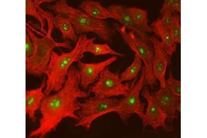 IF analysis of SPT5/SUPT5H using anti-SPT5/SUPT5H antibody (ABIN7601985) and anti-Tubulin beta antibody (ABIN7602744). (SUPT5H anticorps  (AA 533-1087))