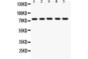 Anti- 12 Lipoxygenase antibody, Western blottingAll lanes: Anti ANOX12  at 0. (ALOX12 anticorps  (C-Term))