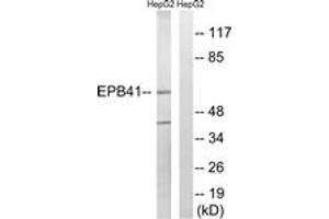 Image no. 1 for anti-Erythrocyte Membrane Protein Band 4.1 (Elliptocytosis 1, RH-Linked) (EPB41) (AA 626-675) antibody (ABIN2889146) (EPB41 anticorps  (AA 626-675))