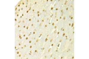 Immunohistochemistry of paraffin-embedded rat brain using SFN Antibody. (14-3-3 sigma/SFN anticorps  (AA 1-248))