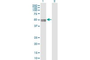 Western Blot analysis of CYP11A1 expression in transfected 293T cell line by CYP11A1 MaxPab polyclonal antibody. (CYP11A1 anticorps  (AA 1-521))