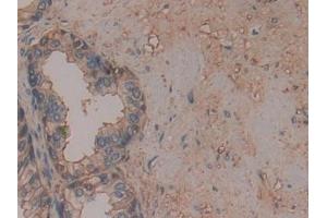 Detection of ANXA6 in Human Prostate Tissue using Polyclonal Antibody to Annexin A6 (ANXA6)