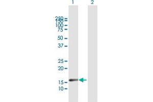 Western Blot analysis of IL20 expression in transfected 293T cell line by IL20 MaxPab polyclonal antibody. (IL-20 anticorps  (AA 1-176))