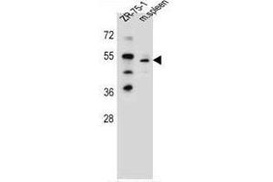 TBX6 Antibody (Center) western blot analysis in ZR-75-1 cell line and mouse spleen tissue lysates (35µg/lane). (T-Box 6 anticorps  (Middle Region))