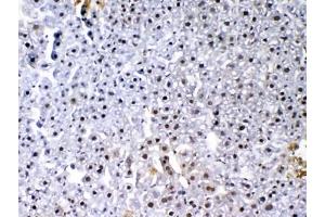 IHC testing of FFPE mouse liver tissue with VEGF Receptor 3 antibody at 1ug/ml. (FLT4 anticorps)