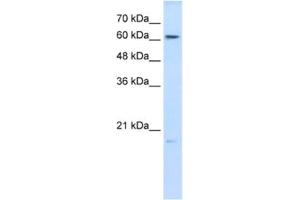 Western Blotting (WB) image for anti-Glutathione Peroxidase 3 (Plasma) (GPX3) antibody (ABIN2462422) (GPX3 anticorps)