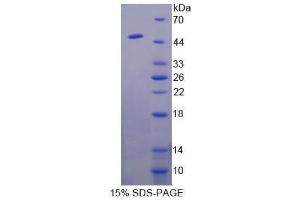 SDS-PAGE (SDS) image for Surfactant Protein A1 (SFTPA1) (AA 112-244) protein (His tag,S tag) (ABIN1525594)
