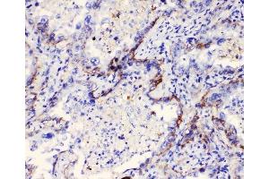 IHC analysis of Integrin alpha 3 using anti-Integrin alpha 3 antibody (ABIN6719410). (ITGA3 anticorps)