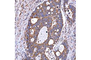 IHC analysis of RAB7/RAB7A using anti-RAB7/RAB7A antibody (ABIN7600597). (RAB7A anticorps  (AA 21-177))