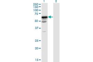 Western Blot analysis of PRPF31 expression in transfected 293T cell line by PRPF31 monoclonal antibody (M02), clone 8E1. (PRPF31 anticorps  (AA 400-499))