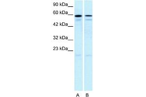 WB Suggested Anti-HTR2C Antibody Titration:  5.