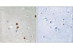 Immunohistochemistry analysis of paraffin-embedded human brain tissue, using CtBP1 (Phospho-Ser422) antibody. (CTBP1 anticorps  (pSer422))