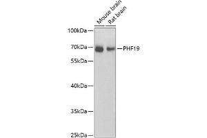 Western blot analysis of extracts of various cell lines, using PHF19 antibody (ABIN6128441, ABIN6145539, ABIN6145540 and ABIN6224090) at 1:1000 dilution. (PHF19 anticorps  (AA 1-207))