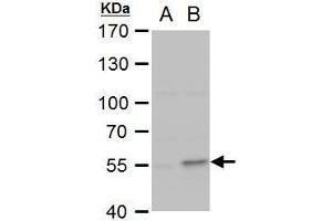 WB Image COL1A2 antibody [C2C3], C-term detects COL1A2 protein by western blot analysis.