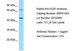 Western Blotting (WB) image for anti-Galactosidase, beta 1 (GLB1) (N-Term) antibody (ABIN970770) (GLB1 anticorps  (N-Term))