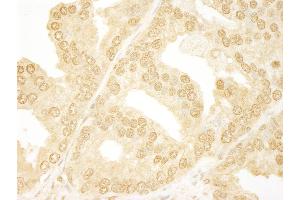 Immunohistochemistry (IHC) image for anti-Ankyrin Repeat Domain 17 (ANKRD17) (AA 1550-1600) antibody (ABIN7448409)