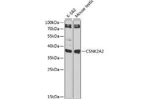 Western blot analysis of extracts of various cell lines, using CSNK2 antibody (ABIN6127663, ABIN6139128, ABIN6139129 and ABIN6217497) at 1:1000 dilution.