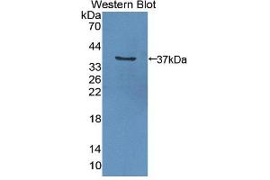 Western blot analysis of the recombinant protein. (GGPS1 anticorps  (AA 1-290))