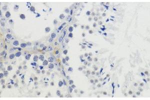Immunohistochemistry of paraffin-embedded Mouse testis using DiMethyl-Histone H4-K20 Polyclonal Antibody at dilution of 1:200 (40x lens).