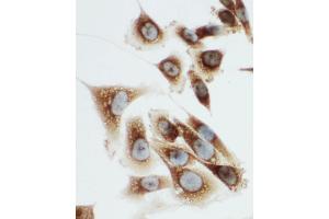 Anti-Kallikrein 6 antibody, ICC ICC: PC-3 Cell