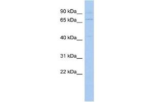 WB Suggested Anti-KLHL3 Antibody Titration: 0. (KLHL3 anticorps  (N-Term))