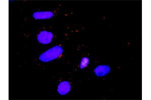Proximity Ligation Analysis of protein-protein interactions between STAT5B and CTLA4.