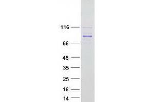 Validation with Western Blot
