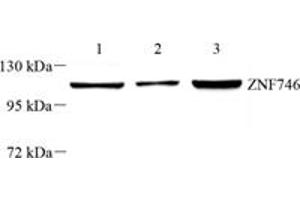 Western blot analysis of PARIS (ABIN7076272) at dilution of 1: 1000,Lane 1: THP-1 cell lysate,Lane 2: SH-SY5Y cell lysate,Lane 3: U251 cell lysate (ZNF746 anticorps)