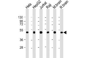 Western Blot at 1:2000 dilution Lane 1: Hela whole cell lysate Lane 2: HepG2 whole cell lysate Lane 3: Jurkat whole cell lysate Lane 4: Raji whole cell lysate Lane 5: mouse brain lysate Lane 6: rat brain lysate Lysates/proteins at 20 ug per lane. (CTBP1 anticorps  (C-Term))