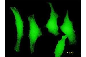 Immunofluorescence of purified MaxPab antibody to PELO on HeLa cell.