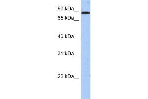 WB Suggested Anti-TMTC1 Antibody Titration:  0. (TMTC1 anticorps  (Middle Region))