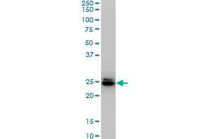 HMGB2 monoclonal antibody (M02), clone 4G7. (HMGB2 anticorps  (AA 1-195))