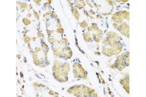 Immunohistochemistry of paraffin-embedded Human stomach using MLN Polyclonal Antibody at dilution of 1:100 (40x lens). (Motilin anticorps)