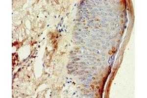 Immunohistochemistry of paraffin-embedded human skin tissue using ABIN7149004 at dilution of 1:100