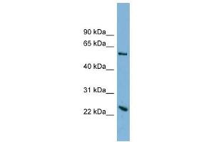 TMEM161A antibody used at 1 ug/ml to detect target protein. (TMEM161A anticorps  (Middle Region))