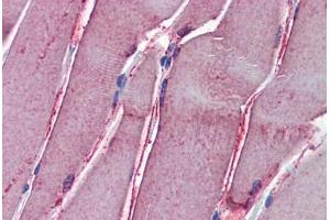 Human Skeletal Muscle: Formalin-Fixed, Paraffin-Embedded (FFPE) (GSTM2 anticorps  (AA 90-190))