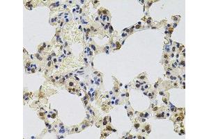 Immunohistochemistry of paraffin-embedded Rat lung using GTF2H2 Polyclonal Antibody at dilution of 1:100 (40x lens). (GTF2H2 anticorps)