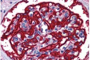 Human Kidney: Formalin-Fixed, Paraffin-Embedded (FFPE)