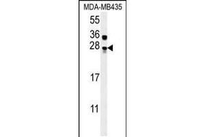 Western blot analysis in MDA-MB435 cell line lysates (15ug/lane). (MUTED anticorps  (AA 40-68))