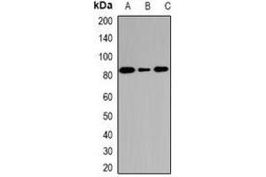 Western blot analysis of DCTD expression in SW620 (A), mouse heart (B), rat heart (C) whole cell lysates. (DCMP Deaminase (DCTD) anticorps)