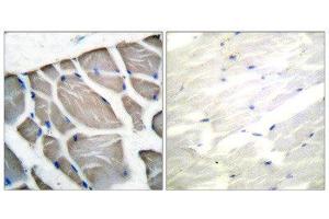 Immunohistochemistry (IHC) image for anti-Actin (pan) antibody (ABIN1848426)