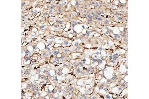 IHC analysis of Actin using anti-Actin antibody (ABIN3043519).