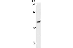 Gel: 10 % SDS-PAGE, Lysate: 40 μg, Lane: 231 cells, Primary antibody: ABIN7192403(SLC16A4 Antibody) at dilution 1/1200, Secondary antibody: Goat anti rabbit IgG at 1/8000 dilution, Exposure time: 10 seconds