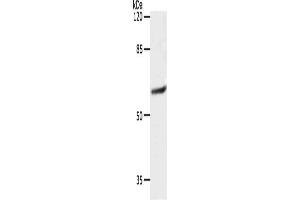 Gel: 10 % SDS-PAGE, Lysate: 40 μg, Lane: 231 cells, Primary antibody: ABIN7192403(SLC16A4 Antibody) at dilution 1/1200, Secondary antibody: Goat anti rabbit IgG at 1/8000 dilution, Exposure time: 10 seconds (SLC16A4 anticorps)