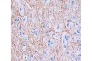 Used in DAB staining on fromalin fixed paraffin- embedded Kidney tissue (Calneuron 1 anticorps  (AA 1-192))